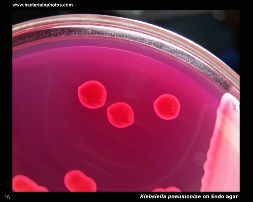 klebsiella pneumoniae on Endo agar